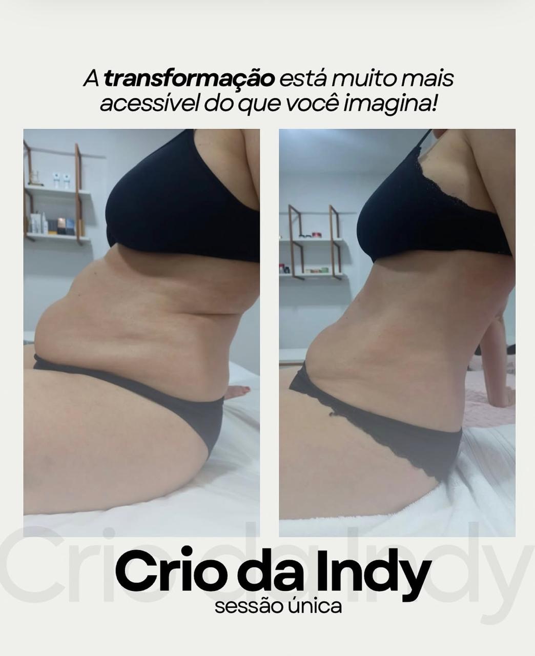Método Crio da Indi - Caso 9